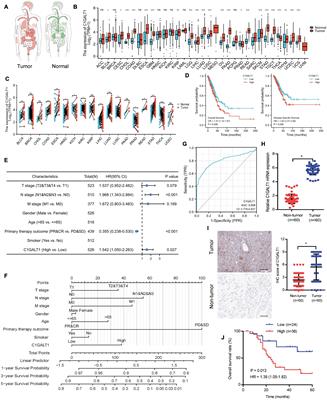 C1GALT1, Negatively Regulated by miR-181d-5p, Promotes Tumor Progression via Upregulating RAC1 in Lung Adenocarcinoma